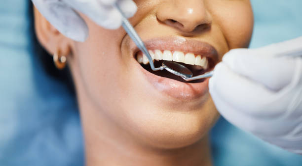 Best Dental Abscess Treatment in Grant, AL